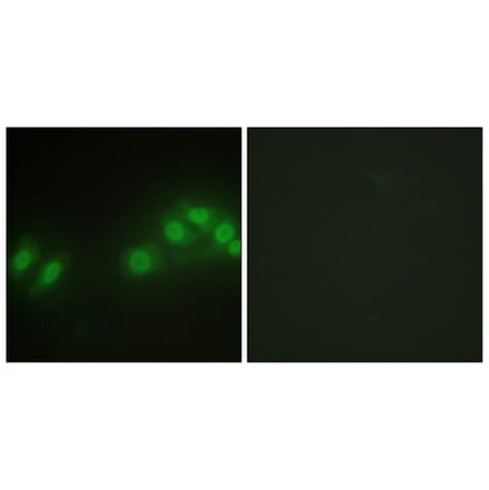 Immunofluorescence - Anti-LATS2 Antibody (C11751) - Antibodies.com