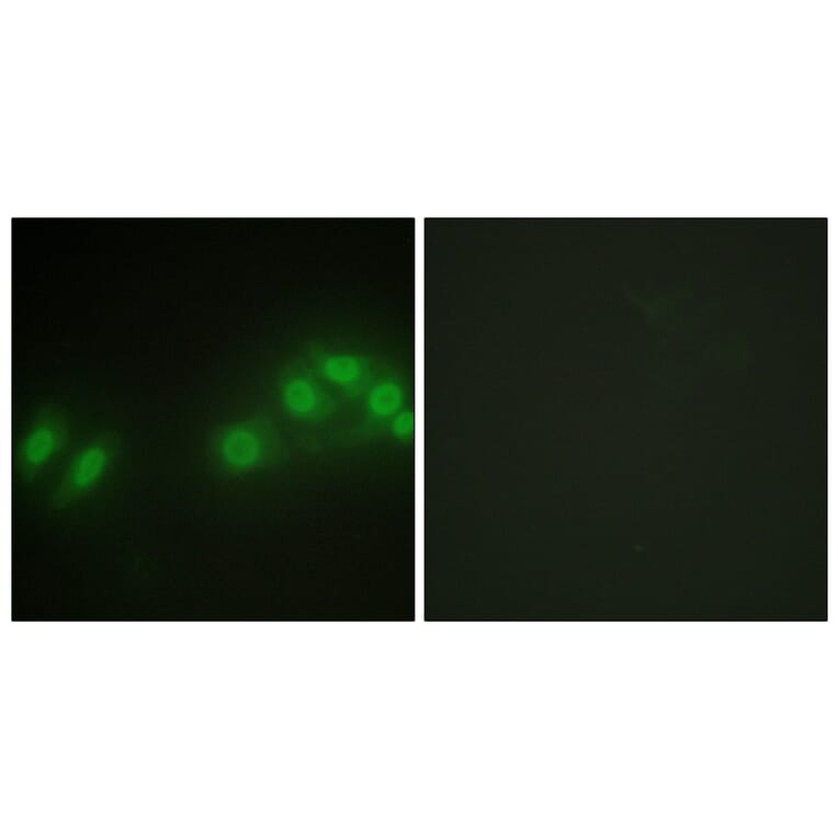 Immunofluorescence - Anti-LATS2 Antibody (C11751) - Antibodies.com