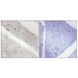 Immunohistochemistry - Anti-LATS2 Antibody (C11751) - Antibodies.com