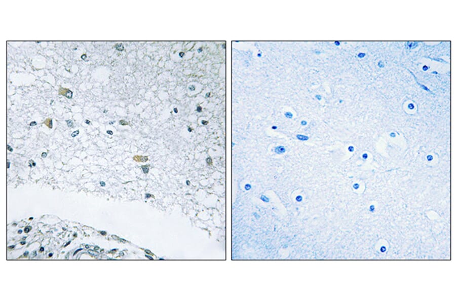 Immunohistochemistry - Anti-LAMC3 Antibody (C13074) - Antibodies.com