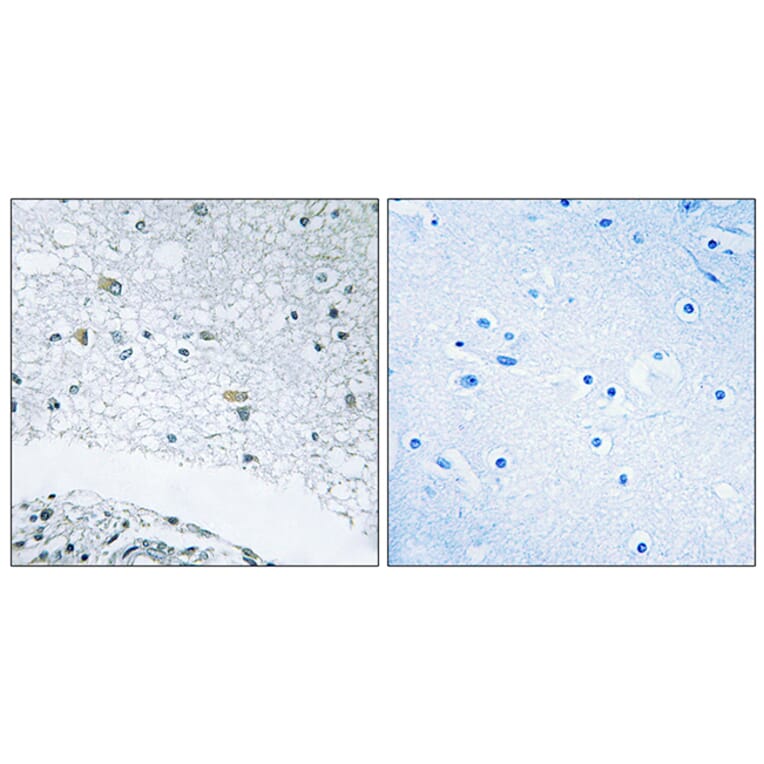 Immunohistochemistry - Anti-LAMC3 Antibody (C13074) - Antibodies.com