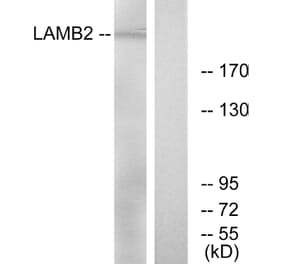 Western Blot - Anti-LAMB2 Antibody (C13070) - Antibodies.com