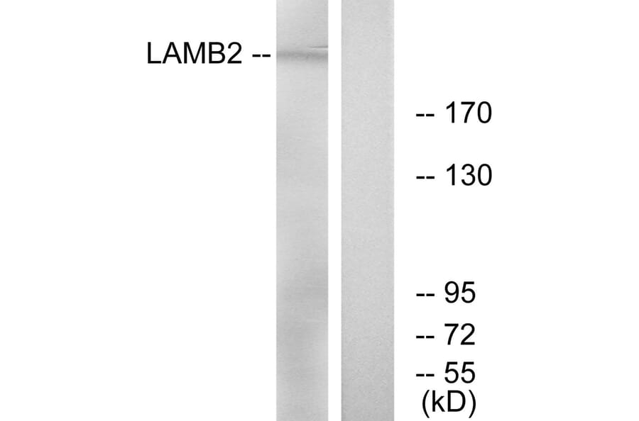 Western Blot - Anti-LAMB2 Antibody (C13070) - Antibodies.com