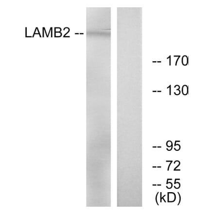 Western Blot - Anti-LAMB2 Antibody (C13070) - Antibodies.com