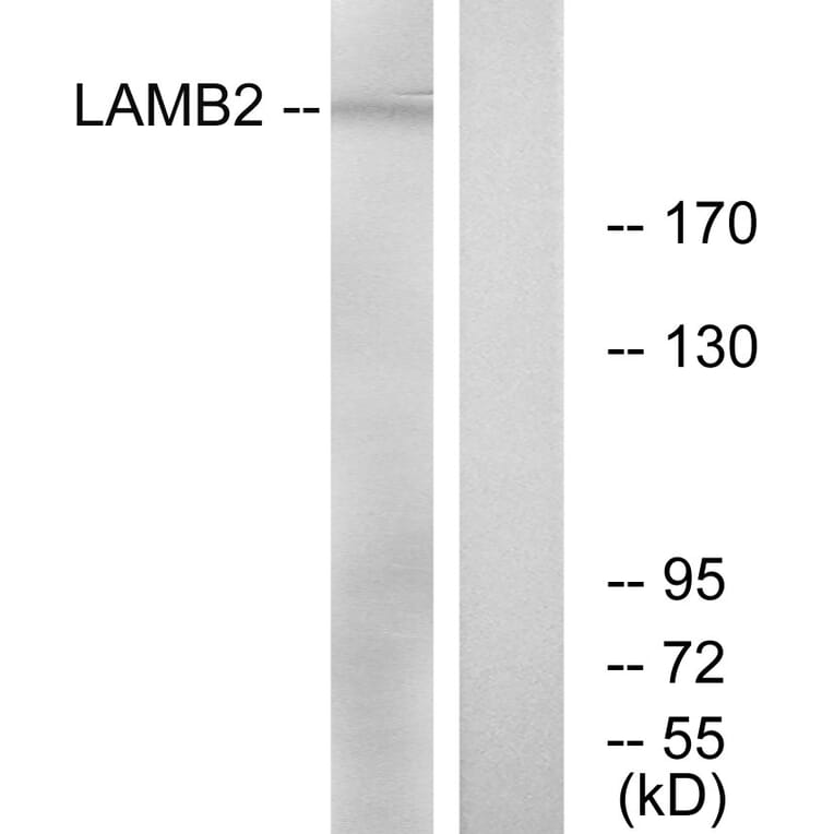 Western Blot - Anti-LAMB2 Antibody (C13070) - Antibodies.com