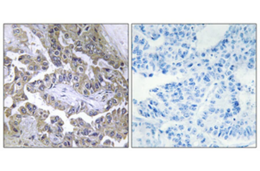 Immunohistochemistry - Anti-LAMB2 Antibody (C13070) - Antibodies.com