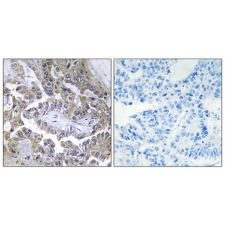 Immunohistochemistry - Anti-LAMB2 Antibody (C13070) - Antibodies.com