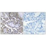 Immunohistochemistry - Anti-LAMB2 Antibody (C13070) - Antibodies.com