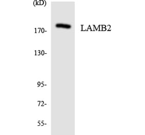 Western Blot - Anti-LAMB2 Antibody (R12-2959) - Antibodies.com