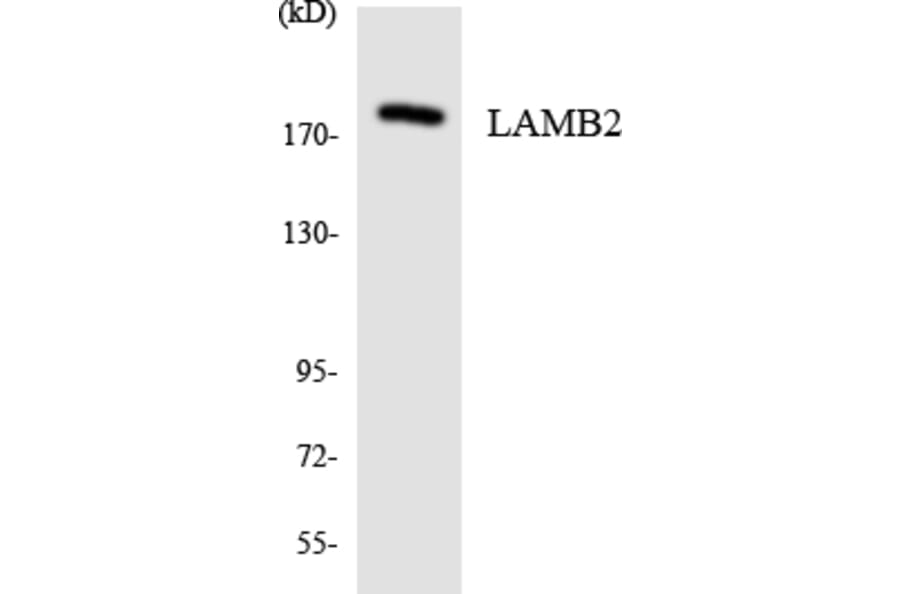 Western Blot - Anti-LAMB2 Antibody (R12-2959) - Antibodies.com