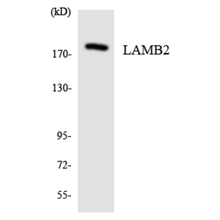 Western Blot - Anti-LAMB2 Antibody (R12-2959) - Antibodies.com