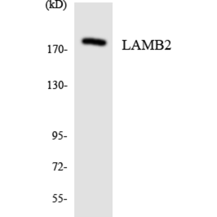 Western Blot - Anti-LAMB2 Antibody (R12-2959) - Antibodies.com