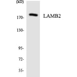 Western Blot - Anti-LAMB2 Antibody (R12-2959) - Antibodies.com