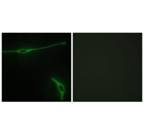 Immunofluorescence - Anti-LAMA2 Antibody (C13065) - Antibodies.com