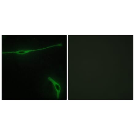 Immunofluorescence - Anti-LAMA2 Antibody (C13065) - Antibodies.com