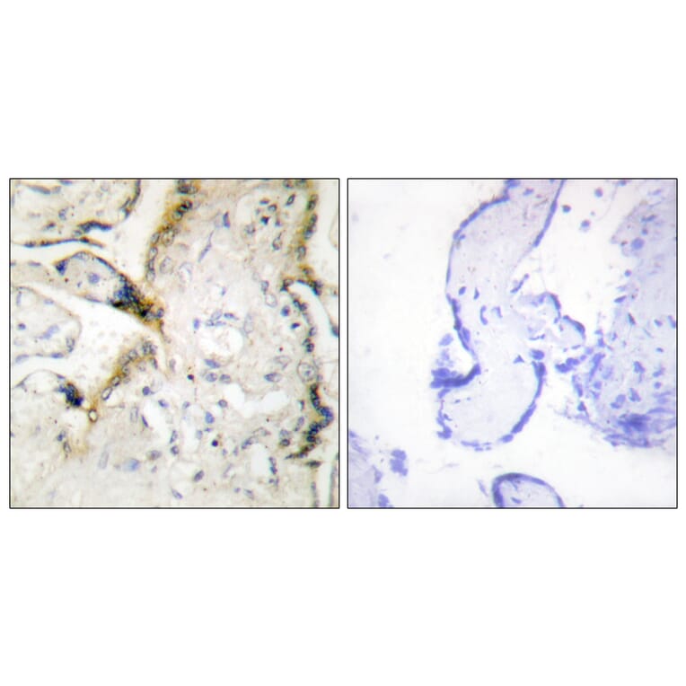 Immunohistochemistry - Anti-LAMA2 Antibody (C13065) - Antibodies.com