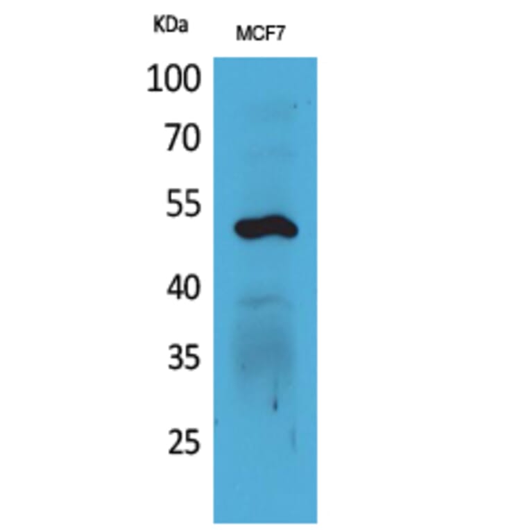 Western Blot - Anti-KRT14 Antibody (C30088) - Antibodies.com