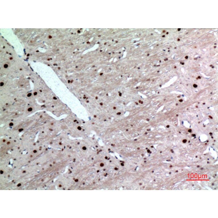 Immunohistochemistry - Anti-KRT14 Antibody (C30088) - Antibodies.com