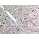 Immunohistochemistry - Anti-KRT14 Antibody (C30088) - Antibodies.com
