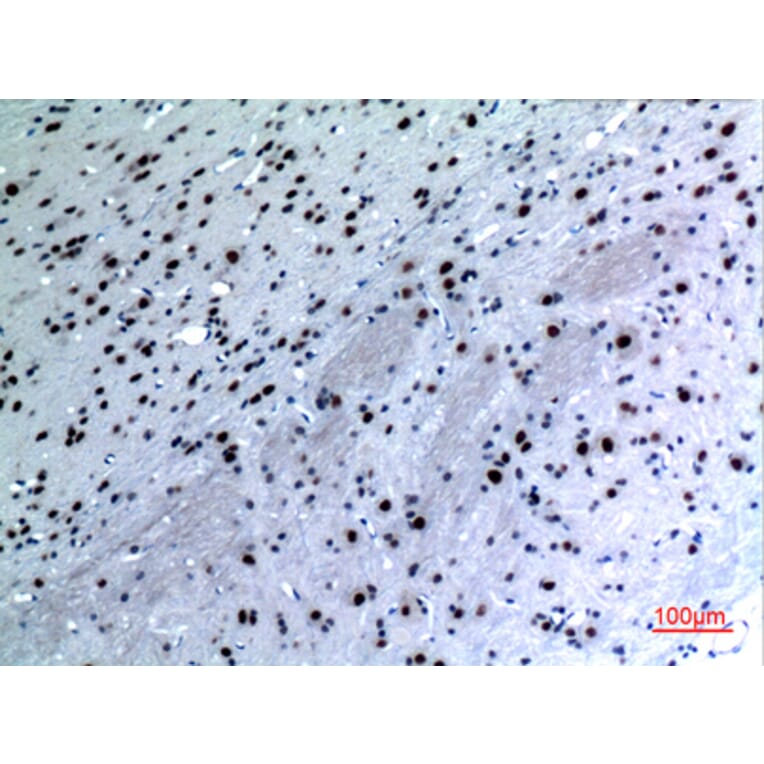 Immunohistochemistry - Anti-KRT14 Antibody (C30088) - Antibodies.com