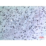 Immunohistochemistry - Anti-KRT14 Antibody (C30088) - Antibodies.com