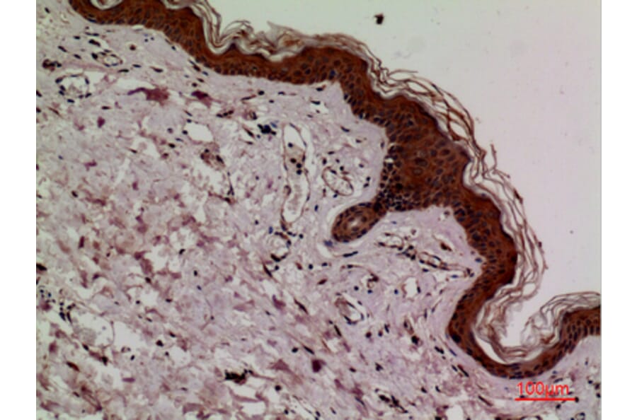 Immunohistochemistry - Anti-KEAP1 Antibody (C30246) - Antibodies.com