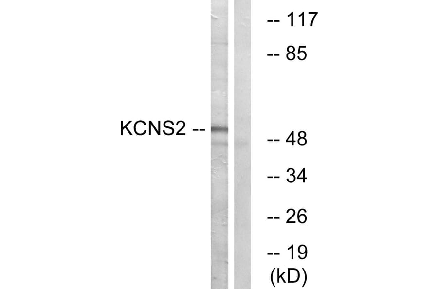 Western Blot - Anti-KCNS2 Antibody (C17827) - Antibodies.com