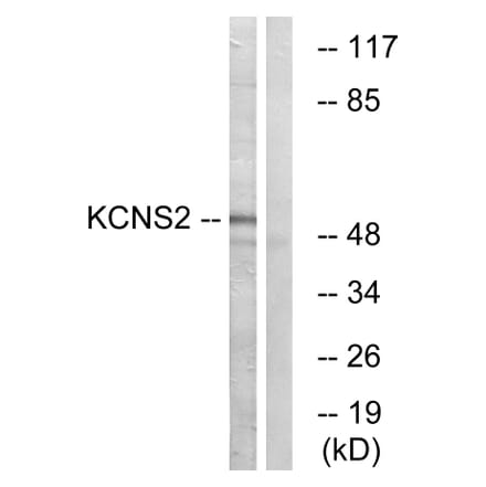 Western Blot - Anti-KCNS2 Antibody (C17827) - Antibodies.com