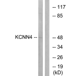 Western Blot - Anti-KCNN4 Antibody (C16393) - Antibodies.com