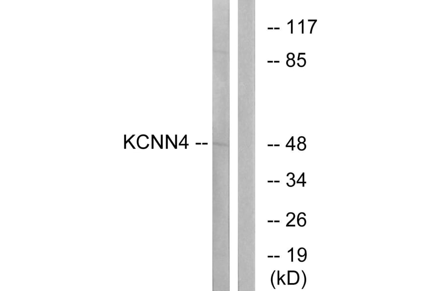 Western Blot - Anti-KCNN4 Antibody (C16393) - Antibodies.com
