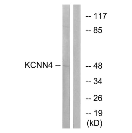 Western Blot - Anti-KCNN4 Antibody (C16393) - Antibodies.com