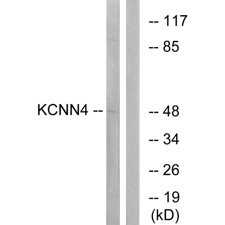 Western Blot - Anti-KCNN4 Antibody (C16393) - Antibodies.com