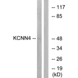 Western Blot - Anti-KCNN4 Antibody (C16393) - Antibodies.com