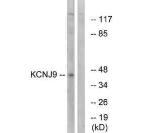 Western Blot - Anti-KCNJ9 Antibody (C15829) - Antibodies.com