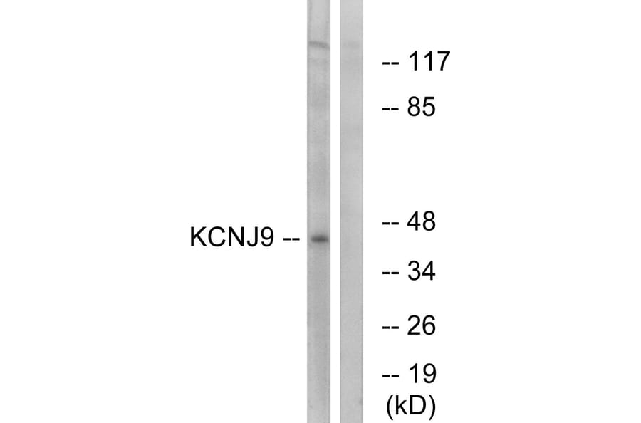 Western Blot - Anti-KCNJ9 Antibody (C15829) - Antibodies.com