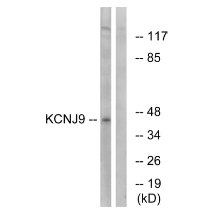 Western Blot - Anti-KCNJ9 Antibody (C15829) - Antibodies.com