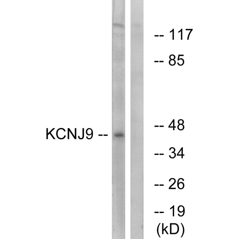 Western Blot - Anti-KCNJ9 Antibody (C15829) - Antibodies.com