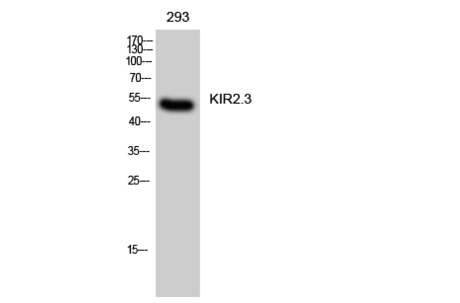 Western Blot - Anti-KCNJ4 Antibody (C21080) - Antibodies.com