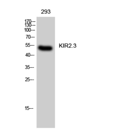 Western Blot - Anti-KCNJ4 Antibody (C21080) - Antibodies.com