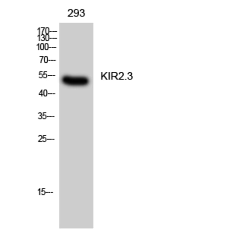 Western Blot - Anti-KCNJ4 Antibody (C21080) - Antibodies.com