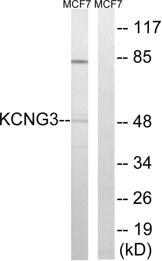 Western blot analysis of lysates from MCF-7 cells using Anti-KCNG3 Antibody. The right hand lane represents a negative control, where the antibody is blocked by the immunising peptide.