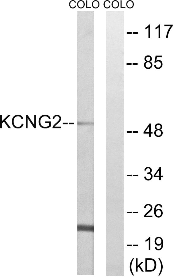 Western blot analysis of lysates from COLO cells using Anti-KCNG2 Antibody. The right hand lane represents a negative control, where the antibody is blocked by the immunising peptide.