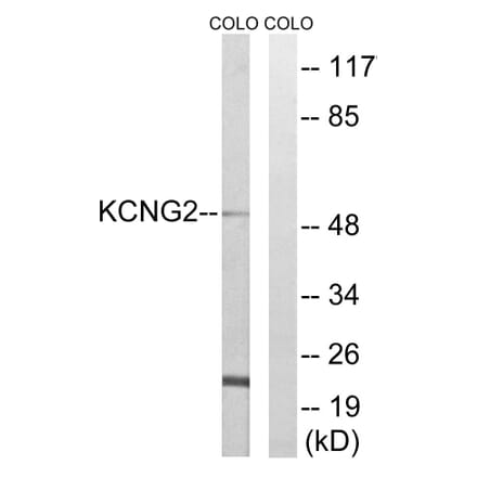 Western Blot - Anti-KCNG2 Antibody (C17810) - Antibodies.com