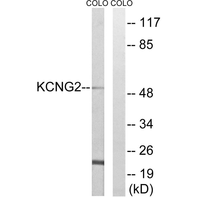 Western Blot - Anti-KCNG2 Antibody (C17810) - Antibodies.com