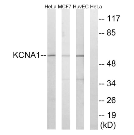 Western Blot - Anti-KCNA1 Antibody (C17789) - Antibodies.com