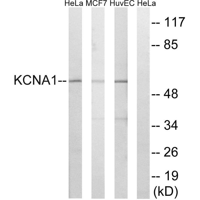 Western Blot - Anti-KCNA1 Antibody (C17789) - Antibodies.com