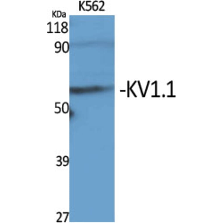 Western Blot - Anti-KCNA1 Antibody (C17789) - Antibodies.com