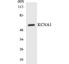 Western Blot - Anti-KCNA1 Antibody (R12-2944) - Antibodies.com
