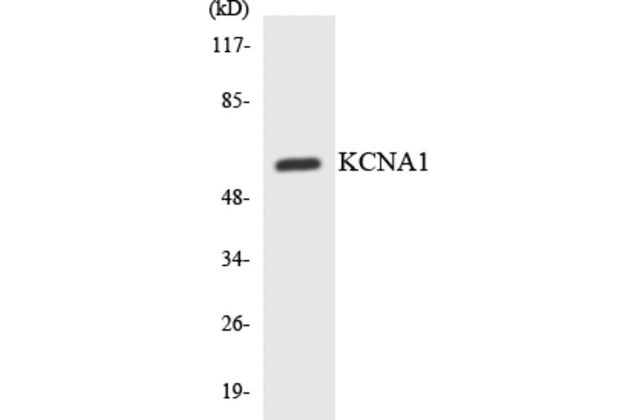 Western Blot - Anti-KCNA1 Antibody (R12-2944) - Antibodies.com