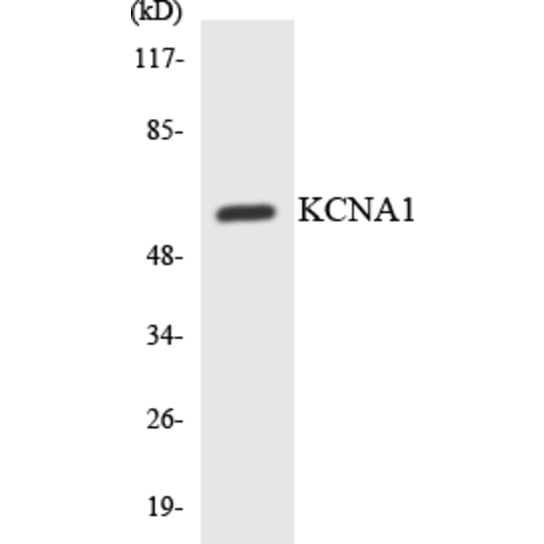 Western Blot - Anti-KCNA1 Antibody (R12-2944) - Antibodies.com